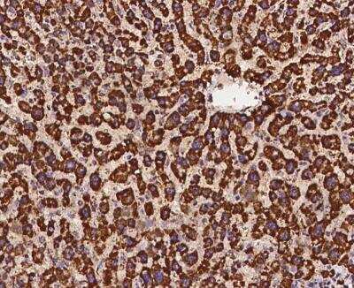 Immunohistochemistry-Paraffin: Ndufs1 Antibody [NBP3-12701] - Staining of human NDUFS1 in human liver with rabbit polyclonal antibody at 1:1000 dilution.