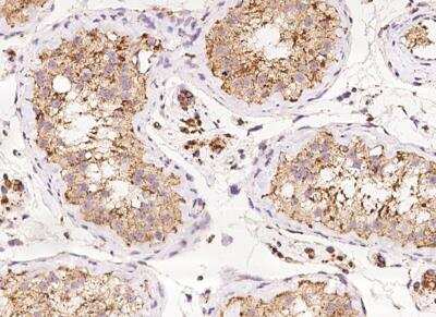 Immunohistochemistry-Paraffin: Ndufs1 Antibody [NBP3-12701] - Staining of human NDUFS1 in human testis with rabbit polyclonal antibody at 1:1000 dilution.