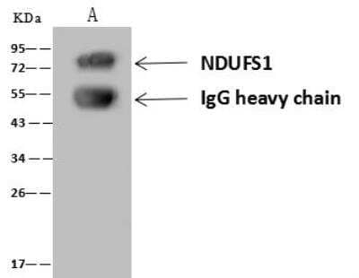 Immunoprecipitation: Ndufs1 Antibody [NBP3-12701] - Lane A:0.5 mg HeLa Whole Cell Lysate4 uL anti-NDUFS1 rabbit polyclonal antibody and 60 ug of Immunomagnetic beads Protein A/G.Primary antibody:Anti-NDUFS1 rabbit polyclonal antibody,at 1:100 dilution Secondary antibody:Goat Anti-Rabbit IgG (H+L)/HRP at 1/10000 dilutionDeveloped using the ECL technique.Performed under reducing conditions.Predicted band size: 79 kDaObserved band size :72 kDa