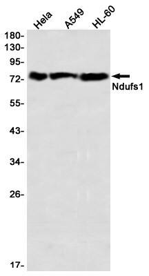 Western Blot: Ndufs1 Antibody (S02-3I2) [NBP3-19894] - Western blot detection of Ndufs1 in Hela, A549, HL-60 using NBP3-19894 (1:1000 diluted)
