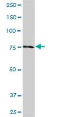 Western Blot: Ndufs1 Antibody [H00004719-B01P] - Analysis of NDUFS1 expression in human spleen.
