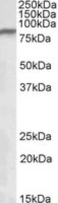 Western Blot: Ndufs1 Antibody [NBP1-52060] - Staining of Human Heart lysate (35 ug protein in RIPA buffer). Antibody at 0.3 ug/mL. Primary incubation was 1 hour. Detected by chemiluminescence.