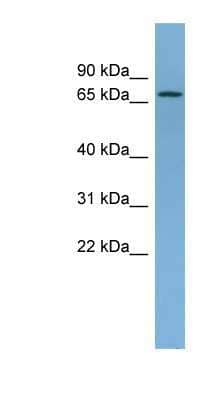 Western Blot: Ndufs1 Antibody [NBP1-56520] - Titration: 0.2-1 ug/ml, Positive Control: Human Liver.