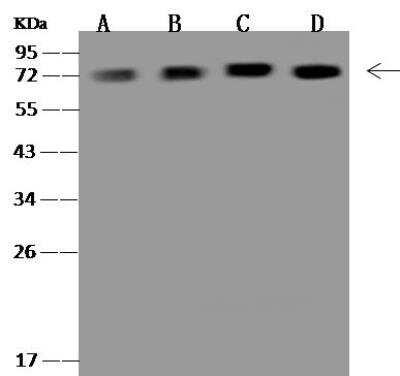 Western Blot: Ndufs1 Antibody [NBP3-12701] - Lane A: Raji Whole Cell LysateLane B: HepG2 Whole Cell LysateLane C: HeLa Whole Cell LysateLane D: Jurkat Whole Cell LysateLysates/proteins at 30 ug per lane.SecondaryGoat Anti-Rabbit IgG (H+L)/HRP at 1/10000 dilution.Developed using the ECL technique.Performed under reducing conditions.Predicted band size:79 kDaObserved band size:72 kDa