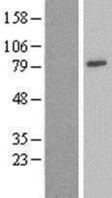 Western Blot: Ndufs1 Overexpression Lysate (Adult Normal) [NBL1-13560] Left-Empty vector transfected control cell lysate (HEK293 cell lysate); Right -Over-expression Lysate for Ndufs1.