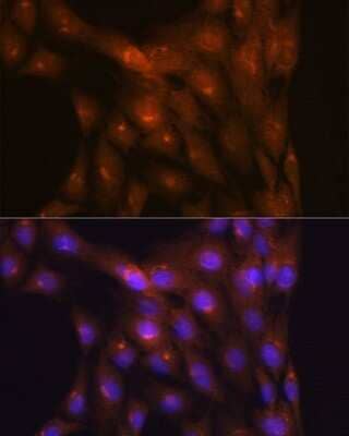 Immunocytochemistry/Immunofluorescence: Ndufs4 Antibody (6T10F4) [NBP3-16679] - Immunofluorescence analysis of C6 cells using Ndufs4 Rabbit mAb (NBP3-16679) at dilution of 1:100 (40x lens). Blue: DAPI for nuclear staining.