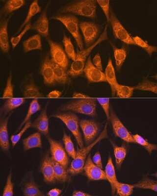 Immunocytochemistry/Immunofluorescence: Ndufs4 Antibody (6T10F4) [NBP3-16679] - Immunofluorescence analysis of NIH-3T3 cells using Ndufs4 Rabbit mAb (NBP3-16679) at dilution of 1:100 (40x lens). Blue: DAPI for nuclear staining.