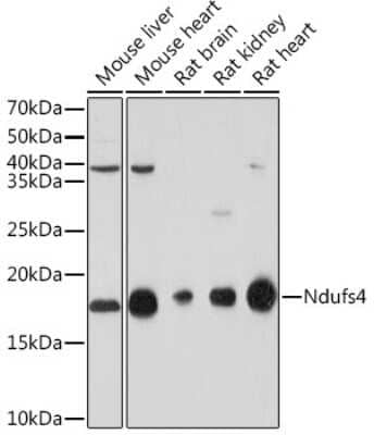 Western Blot: Ndufs4 Antibody (6T10F4) [NBP3-16679] - Western blot analysis of extracts of various cell lines, using Ndufs4 Rabbit mAb (NBP3-16679) at 1:1000 dilution. Secondary antibody: HRP Goat Anti-Rabbit IgG (H+L) at 1:10000 dilution. Lysates/proteins: 25ug per lane. Blocking buffer: 3% nonfat dry milk in TBST. Detection: ECL Basic Kit. Exposure time: 30s.