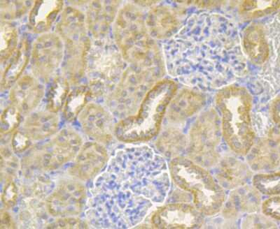 Immunohistochemistry-Paraffin: Ndufs4 Antibody (JE40-47) [NBP2-76851] - Analysis of rat kidney tissue using anti-Ndufs4 antibody. Counter stained with hematoxylin.