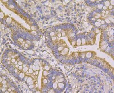 Immunohistochemistry-Paraffin: Ndufs4 Antibody (JE40-47) [NBP2-76851] - Analysis of human small intestine tissue using anti-Ndufs4 antibody. Counter stained with hematoxylin.