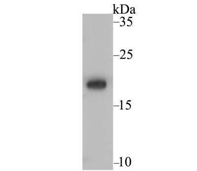 Western Blot: Ndufs4 Antibody (JE40-47) [NBP2-76851] - Analysis of Ndufs4 on rat heart tissue lysate using anti-Ndufs4 antibody at 1/1,000 dilution.