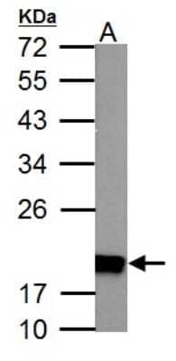 Western Blot: Ndufs4 Antibody [NBP1-31465] - 50 ug Rat heart lysate/extract 12% SDS-PAGE gel, antibody dilution 1:1000.