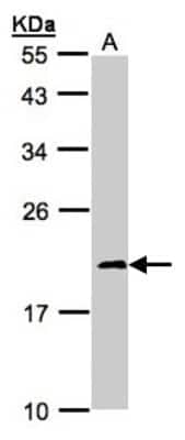 Western Blot: Ndufs4 Antibody [NBP1-31465] - Sample(30ug whole cell lysate) A: 293T 12% SDS PAGE, antibody diluted at 1:1000.