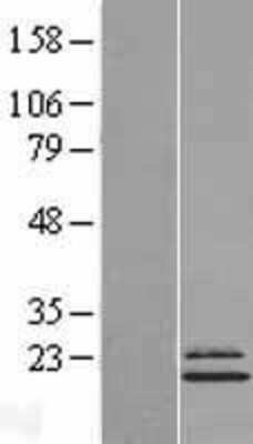 Western Blot: Ndufs4 Overexpression Lysate (Adult Normal) [NBL1-13563] Left-Empty vector transfected control cell lysate (HEK293 cell lysate); Right -Over-expression Lysate for Ndufs4.