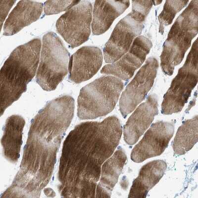 Immunohistochemistry-Paraffin: Nebulin Antibody [NBP1-87752] - Staining of human skeletal muscle shows moderate to strong cytoplasmic positivity in myocytes.