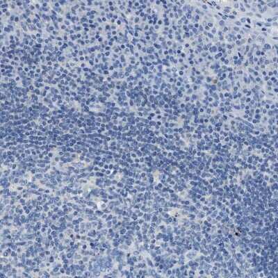 <b>Orthogonal Strategies Validation. </b>Immunohistochemistry-Paraffin: Nebulin Antibody [NBP1-87752] - Staining of human tonsil shows no positivity in lymphoid cells as expected.