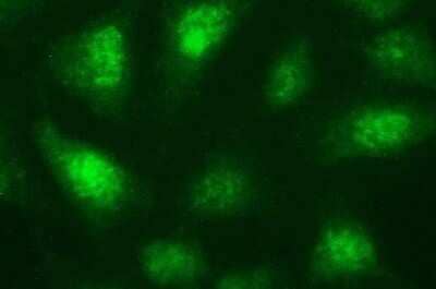 Immunocytochemistry/Immunofluorescence: Necdin Antibody (OTI5D1) - Azide and BSA Free [NBP2-72925] - Analysis of HeLa cells.