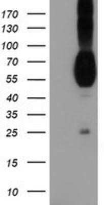 Western Blot: Nectin-1/PVRL1 Antibody (OTI6F8) - Azide and BSA Free [NBP2-72929] - HEK293T cells were transfected with the pCMV6-ENTRY control (Left lane) or pCMV6-ENTRY PVRL1 (Right lane) cDNA for 48 hrs and lysed. Equivalent amounts of cell lysates (5 ug per lane) were separated by SDS-PAGE and immunoblotted with anti-PVRL1.