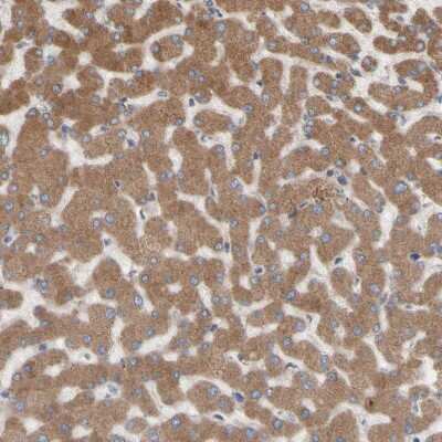 Immunohistochemistry-Paraffin: Nectin-3/PVRL3 Antibody [NBP1-86553] - Staining of human liver shows strong cytoplasmic positivity in hepatocytes.