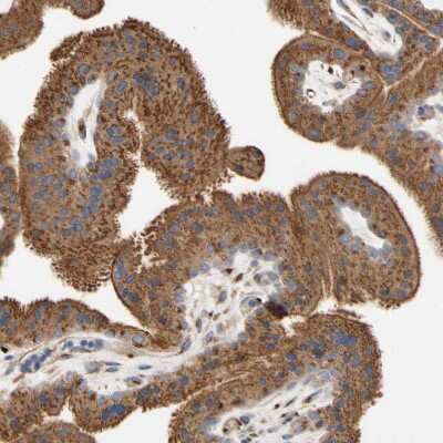 Immunohistochemistry-Paraffin: Nectin-3/PVRL3 Antibody [NBP1-86553] - Staining of human placenta shows strong cytoplasmic positivity in trophoblastic cells.