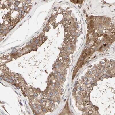 Immunohistochemistry-Paraffin: Nectin-3/PVRL3 Antibody [NBP1-86553] - Staining of human testis shows strong cytoplasmic positivity in cells in seminiferous ducts.