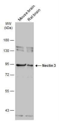 Western Blot: Nectin-3/PVRL3 Antibody [NBP2-20013] - Various tissue extracts (50 ug) were separated by 7.5% SDS-PAGE, and the membrane was blotted with Nectin 3 antibody diluted at 1:10000. The HRP-conjugated anti-rabbit IgG antibody was used to detect the primary antibody.