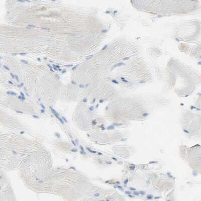 Immunohistochemistry-Paraffin: Nectin-4/PVRL4 Antibody [NBP1-82829] - Staining of human skeletal muscle shows no positivity in myocytes as expected.