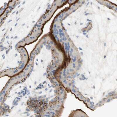 Immunohistochemistry-Paraffin: Nectin-4/PVRL4 Antibody [NBP1-82829] - Staining of human placenta shows moderate membranous positivity in trophoblastic cells.