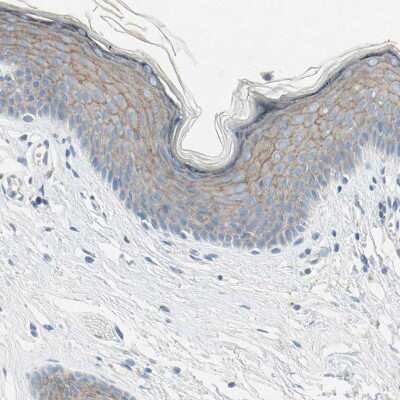 Immunohistochemistry-Paraffin: Nectin-4/PVRL4 Antibody [NBP1-82829] - Staining of human skin shows moderate membranous positivity in keratinocytes.