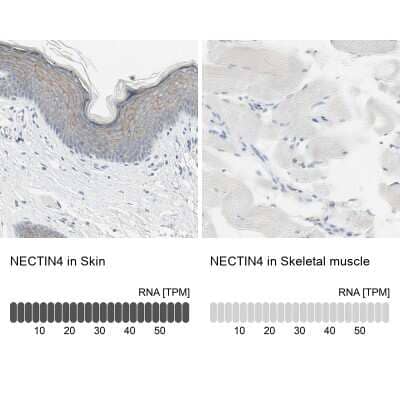 Immunohistochemistry-Paraffin: Nectin-4/PVRL4 Antibody [NBP1-82829] - Staining in human skin and skeletal muscle tissues.. Corresponding NECTIN4 RNA-seq data are presented for the same tissues.
