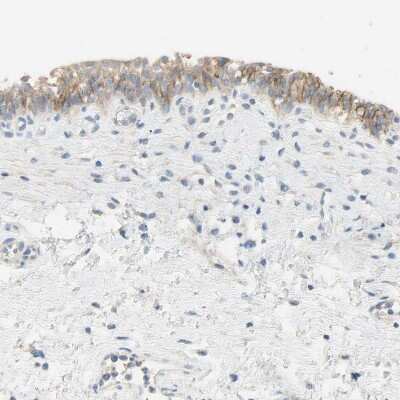 Immunohistochemistry-Paraffin: Nectin-4/PVRL4 Antibody [NBP1-82829] - Staining of human urinary bladder shows moderate membranous positivity in urothelial cells.