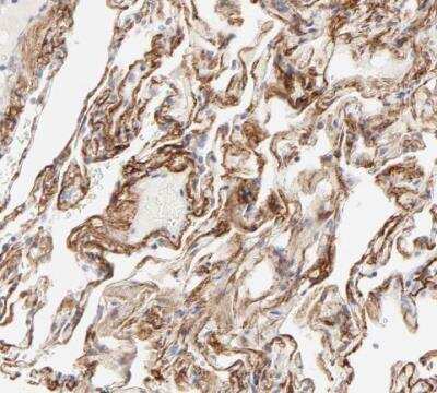 Immunohistochemistry-Paraffin: Nephronectin Antibody [NBP1-83990] - Staining of human lung shows moderate positivity in extracellular matrix pneumocytes.