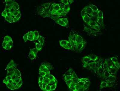 Immunocytochemistry/Immunofluorescence: Neprilysin/CD10 Antibody (113) [NBP2-89226] - Staining of MME in MCF7 cells. Cells were fixed with 4% PFA,blocked with 10% serum, and incubated with rabbit anti-human MME monoclonal antibody (dilution ratio 1:60) at 4c overnight. Then cells were stained with the Alexa Fluor (R) 488-conjugated Goat Anti-rabbit IgG secondary antibody (green). Positive staining was localized to Cell membrane.