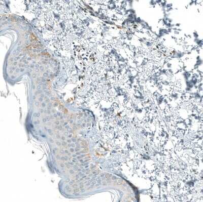 Immunohistochemistry-Paraffin: Neprilysin/CD10 Antibody (CL12448) [NBP3-15135] - Staining of human skin shows very weak positivity in squamous epithelial cells.