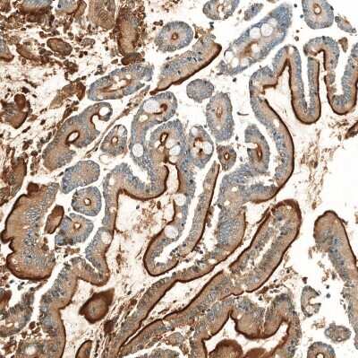Immunohistochemistry-Paraffin: Neprilysin/CD10 Antibody (CL12448) [NBP3-15135] - Staining of human small intestine shows strong apical membranous positivity in glandular cells.