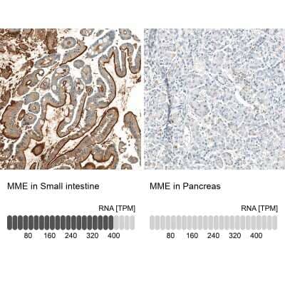 Immunohistochemistry-Paraffin: Neprilysin/CD10 Antibody (CL12448) [NBP3-15135] - Analysis in human small intestine and pancreas tissues using NBP3-15135 antibody. Corresponding MME RNA-seq data are presented for the same tissues.