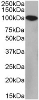 Western Blot: Neprilysin/CD10 Antibody (FR4D11) - Chimeric [NBP3-12068] - Daudi cell lysate (35ug protein in RIPA buffer) was resolved on a SDS PAGE gel and blots were probed with the chimeric rabbit version of FR4D11 (NBP3-12068) at 2 ug/ml before detection using an anti-rabbit secondary antibody. A primary incubation of 1h was used and protein was detected by chemiluminescence.