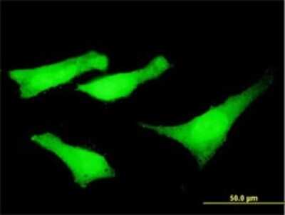 Immunocytochemistry/Immunofluorescence: Nesprin 2 Antibody (5E5) [H00023224-M01] - Analysis of monoclonal antibody to SYNE2 on HeLa cell . Antibody concentration 10 ug/ml.