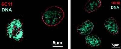 Immunocytochemistry/Immunofluorescence: Nesprin 2 Antibody (6C11) [NBP2-59944] - Immunofluorescence microscopy of HeLa cells. The antibodies can be used on either formaldehyde- or methanol-fixed cells.