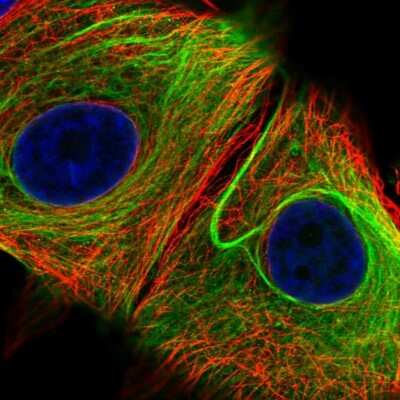 <b>Independent Antibodies Validation. </b>Immunocytochemistry/Immunofluorescence: Nesprin 2 Antibody [NBP2-38620] - Immunofluorescent staining of human cell line MCF7 shows localization to nuclear membrane & intermediate filaments.