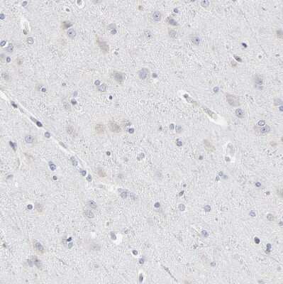 Immunohistochemistry-Paraffin: Nesprin 2 Antibody [NBP1-84190] - Staining of human cerebral cortex shows no positivity in neurons as expected.