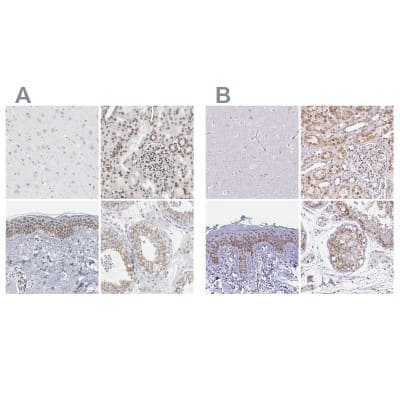 Immunohistochemistry-Paraffin: Nesprin 2 Antibody [NBP1-84190] - Staining of human cerebral cortex, kidney, skin and testis using Anti-SYNE2 antibody NBP1-84190 (A) shows similar protein distribution across tissues to independent antibody NBP2-38620 (B).