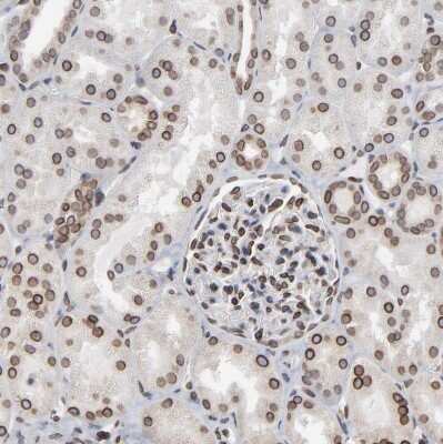 Immunohistochemistry-Paraffin: Nesprin 2 Antibody [NBP1-84190] - Staining of human kidney shows moderate to strong positivity in nuclear membrane in cells in tubules.