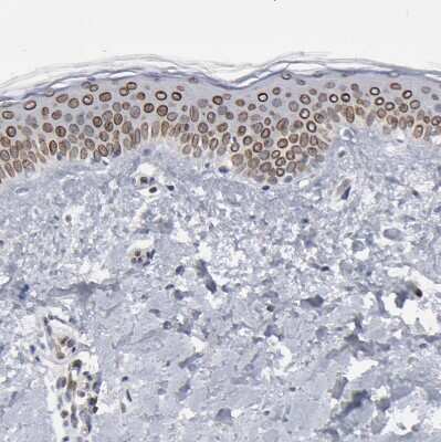 Immunohistochemistry-Paraffin: Nesprin 2 Antibody [NBP1-84190] - Staining of human skin shows moderate positivity in nuclear membrane in squamous epithelial cells.