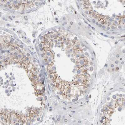 <b>Independent Antibodies Validation. </b>Immunohistochemistry-Paraffin: Nesprin 2 Antibody [NBP1-84190] - Staining of human testis shows moderate membranous positivity in cells in seminiferous ducts.