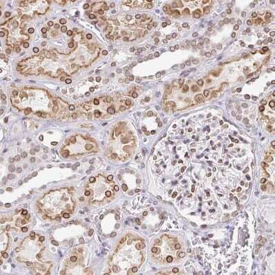 Immunohistochemistry-Paraffin: Nesprin 2 Antibody [NBP2-38620] - Staining of human kidney shows moderate to strong positivity in nuclear membrane in cells in tubules.