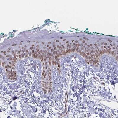 Immunohistochemistry-Paraffin: Nesprin 2 Antibody [NBP2-38620] - Staining of human skin shows moderate positivity in nuclear membrane in squamous epithelial cells.