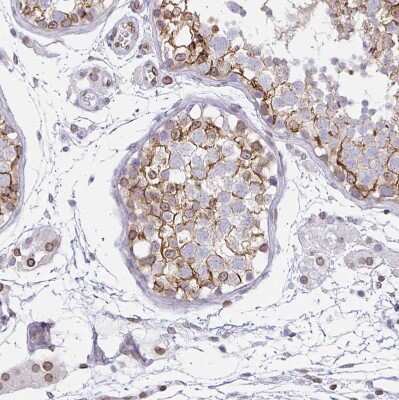 Immunohistochemistry-Paraffin: Nesprin 2 Antibody [NBP2-38620] - Staining of human testis shows moderate membranous positivity in cells in seminiferous ducts.