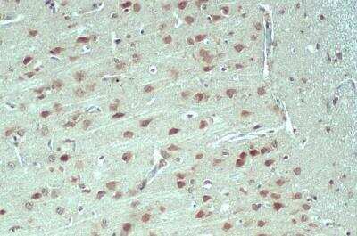 Immunohistochemistry-Paraffin: Nesprin 2 Antibody [NBP2-42886] -  Rat brain. Nesprin 2 stained by Nesprin 2 antibody [C3], C-term diluted at 1:500.Antigen Retrieval: Citrate buffer, pH 6.0, 15 min.