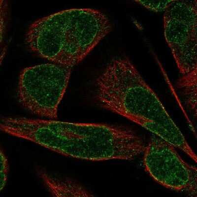 Immunocytochemistry/Immunofluorescence: Nesprin-3 Antibody [NBP2-57690] - Staining of human cell line RH-30 shows localization to nuclear membrane.